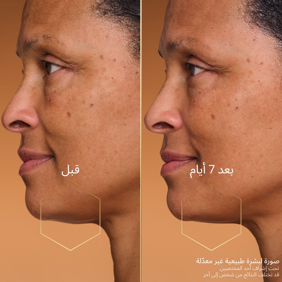 نايت تيبينغ تريتمنت - عبوة إعادة التعبئة (انظر الصورة 6/6)