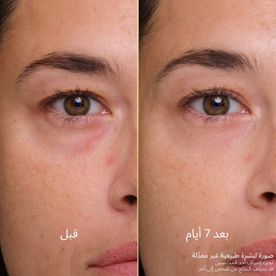مستحضر ميدنايت سيكريت الإسعافي للعناية بالبشرة بعد السهر الطويل (انظر الصورة 6/6)