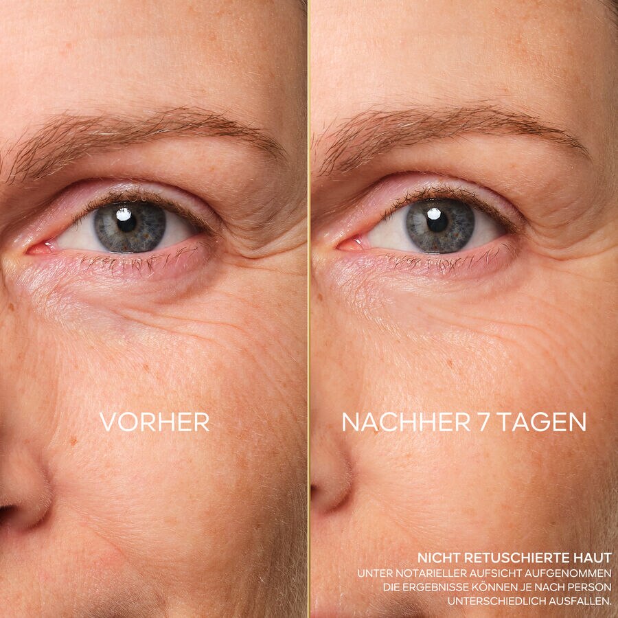 REPARIERENDE AUGENPFLEGE F&Uuml;R JUGENDLICHKEIT (See the picture 6/6)