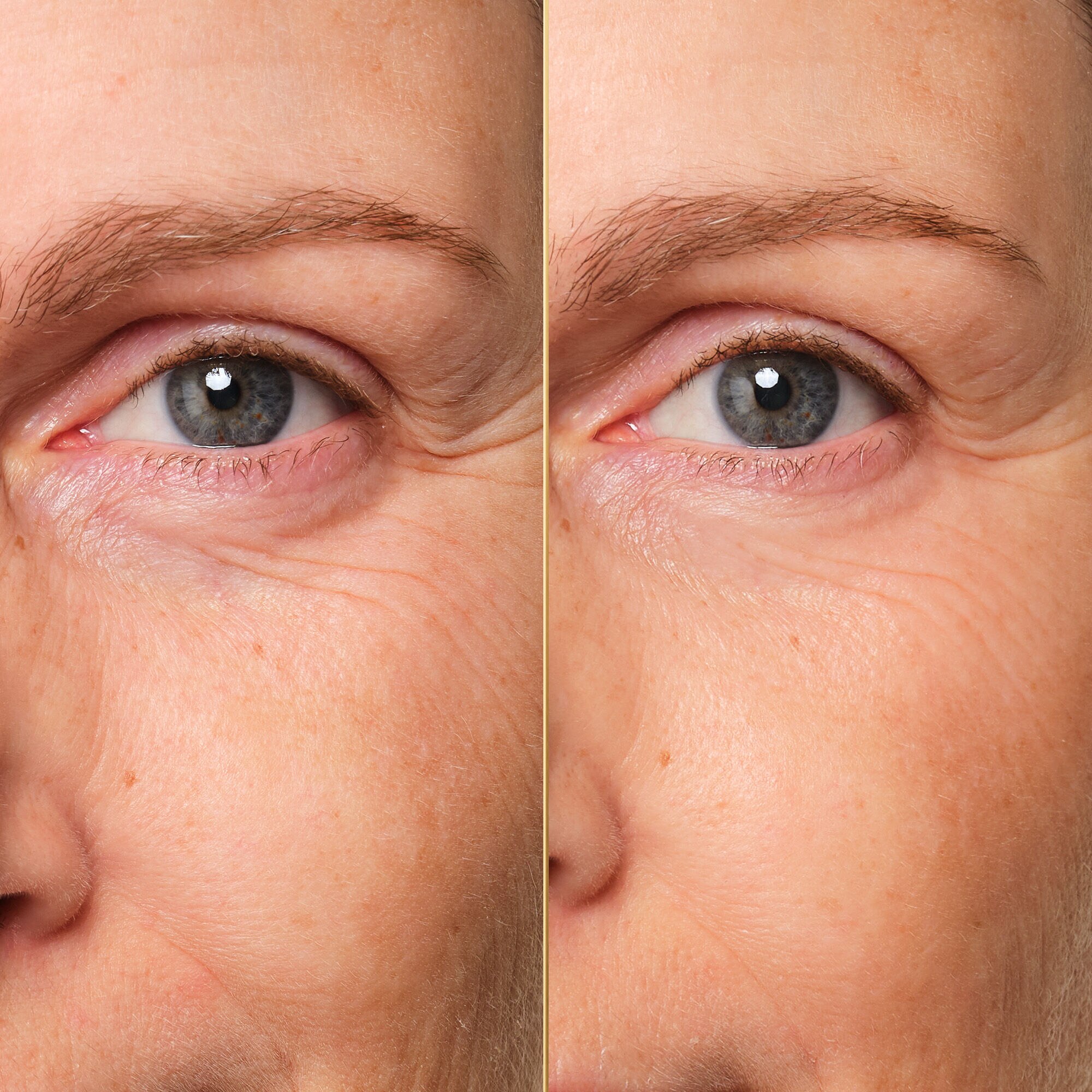 アベイユ ロイヤル ⋅ ユース アイケア クリーム | ゲラン GUERLAIN