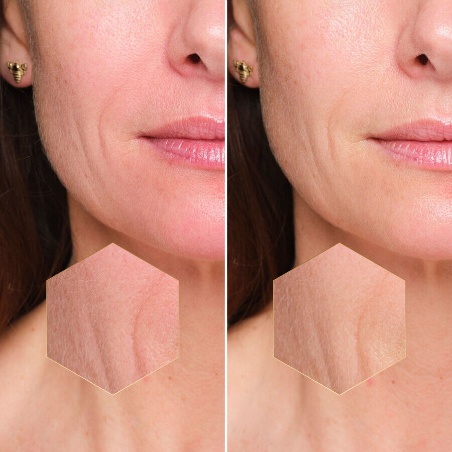 ビー ラボ ショット (See the picture 6/6)