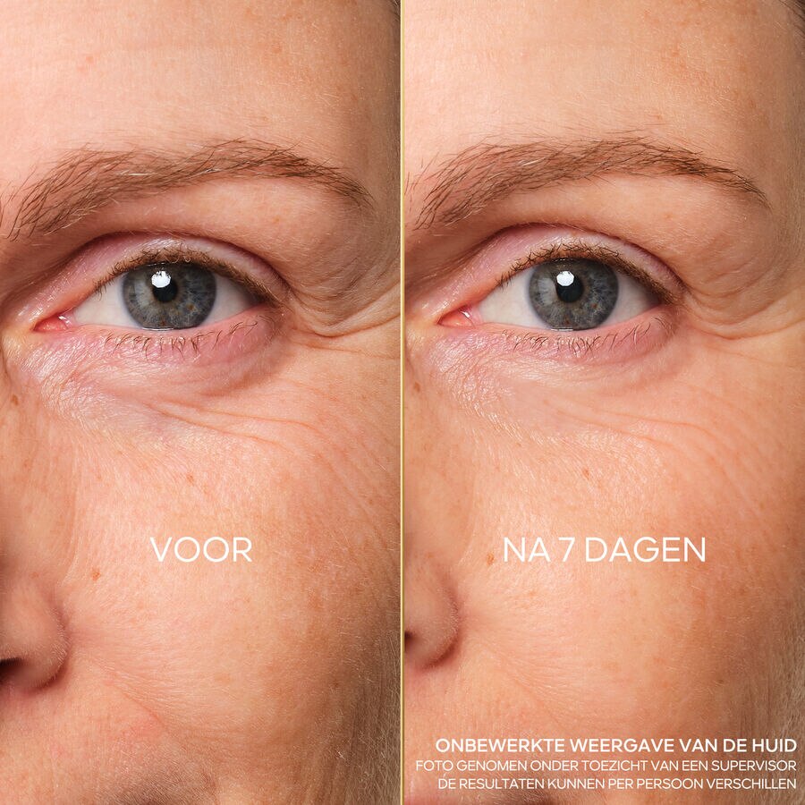 YOUTH REPAIR EYE CARE (De foto bekijken 6/6)