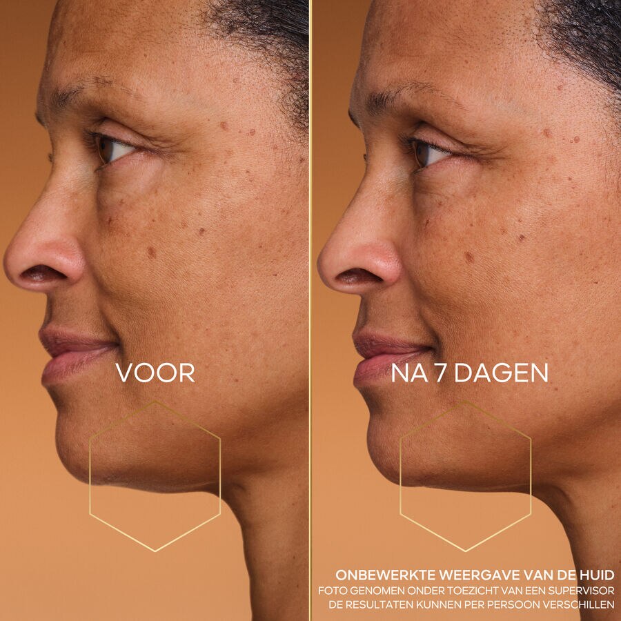 NIGHT-TAPING TREATMENT (De foto bekijken 6/6)