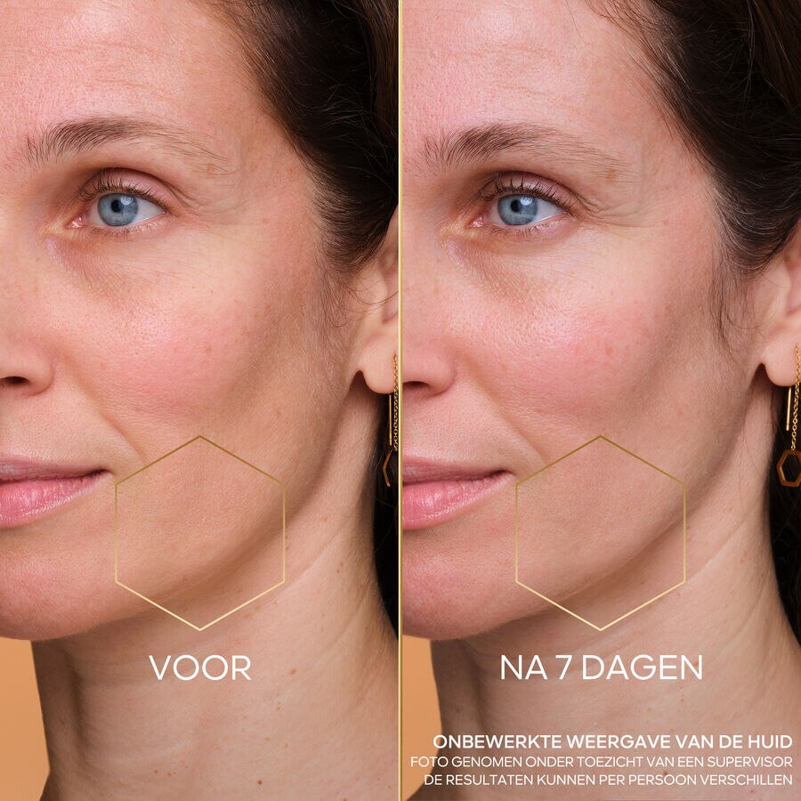 NIGHT-TAPING TREATMENT &ndash; NAVULLING (De foto bekijken 5/6)
