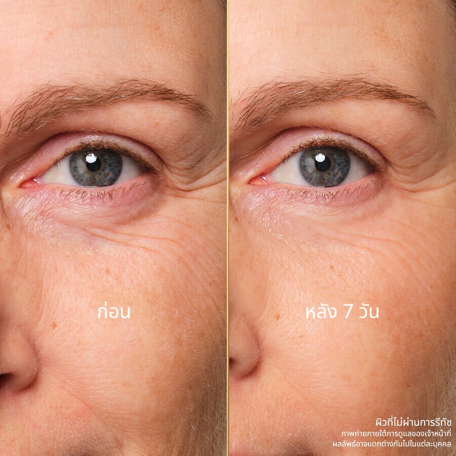 YOUTH REPAIR EYE CARE (See the picture 6/6)